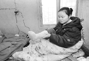 曹小红在一次意外中,失去了半只脚掌 快报记者 施向辉 摄