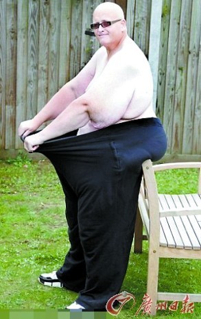 前世界最胖男人减肥292公斤 称渴望过正常人