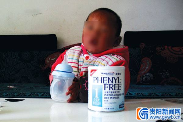 走访患苯丙酮尿症儿童