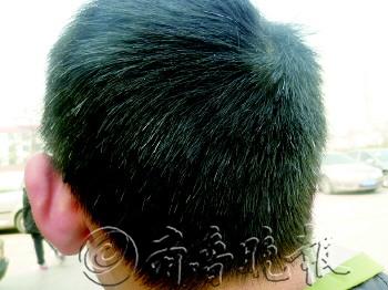 才上初三头发就花白了