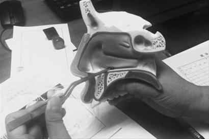 旅游河水洗鼻子 半月后揪出水蛭