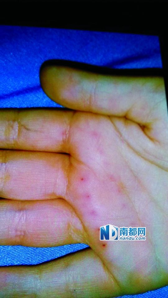 梳子戳小孩手掌胶带封住嘴