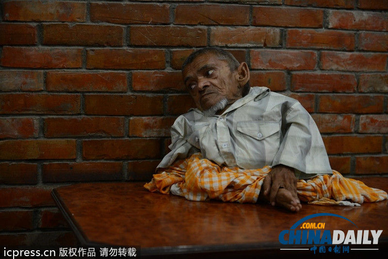 尼泊尔老翁身高仅41厘米 或成“世界最矮”(图)