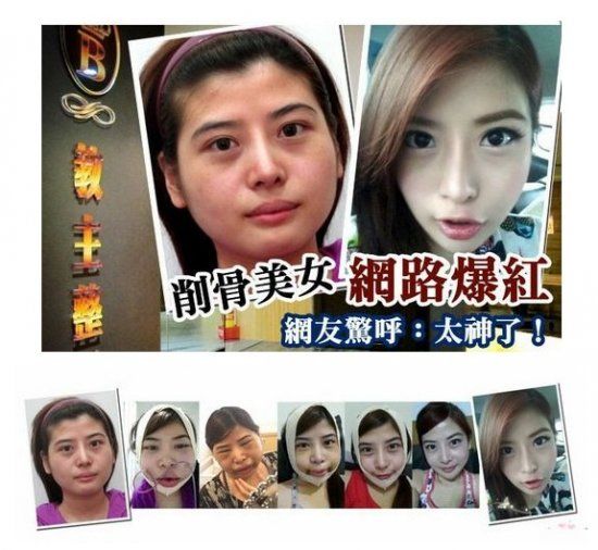 台<em>削骨美女</em>网络爆红 揭为变锥子脸不要命的女