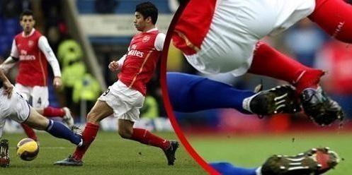 盘点体坛断腿事件