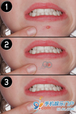 【<em>瑕疵</em>清除器】<em>照片</em>处理_科技频道_凤凰网