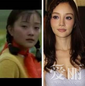 李小璐