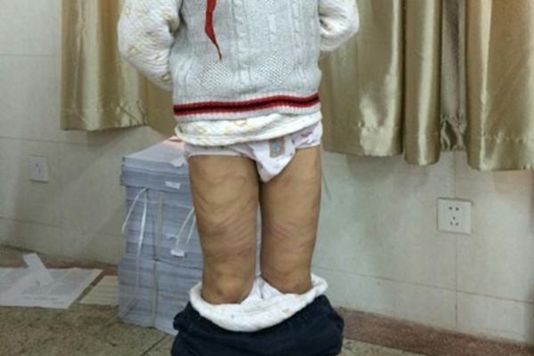 南京虐童案追踪检方对涉事养母不批捕