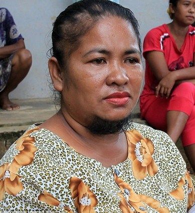 长胡子的女人原标题:印尼女子生完小孩长山羊胡,胸毛剪掉会剧痛中新网