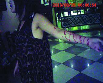 女孩割手臂自残图片图片