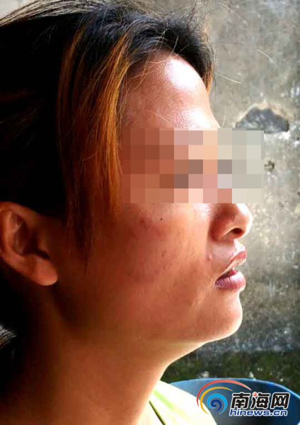 海口一醉酒男子夜闯别人家小院 受惊村妇被他啃脸