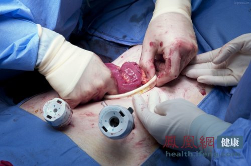 探秘患癌机制这几类人天生就易患癌