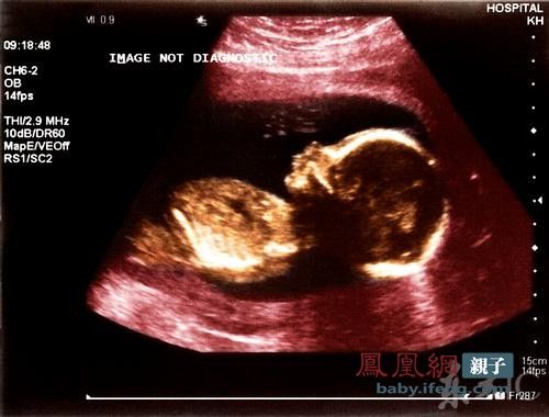 4个月怀孕彩超图片图片