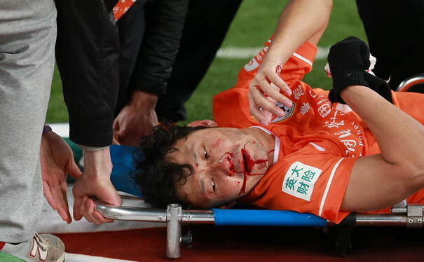 两人血流满面 汪强鼻骨骨折血流满面 鲁能与富力的比赛成为伤病重灾区