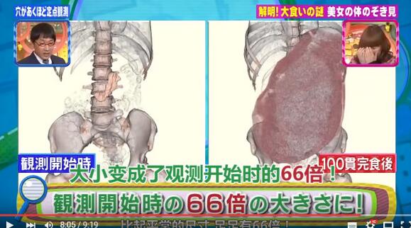 日本美女大胃王吃100个寿司 胃瞬间撑大66倍(图)