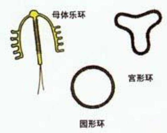 揭秘女性上环全过程组图