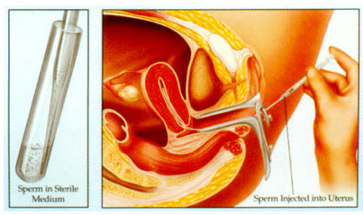 受孕过程工具图片