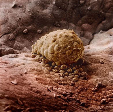 探索人工受孕全过程组图