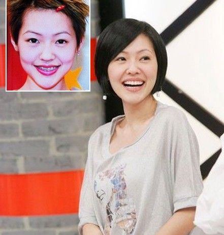 小s郑爽蕾哈娜麦当娜胡歌 盘点明星戴牙套照(组图)