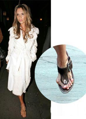 贝嫂因为长期穿高跟鞋,左脚经受高强度的摧残