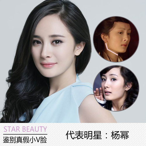 代表明星:杨幂侧脸的角度如果看起来很硬线条,表示有动过;尤其是耳际