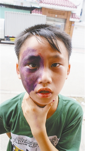 孩子偷摘龙眼被掌掴,老爸持西瓜刀砍邻居