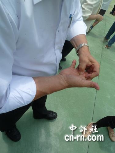 组图卡到鱼刺苏贞昌在学甲流下第一滴血