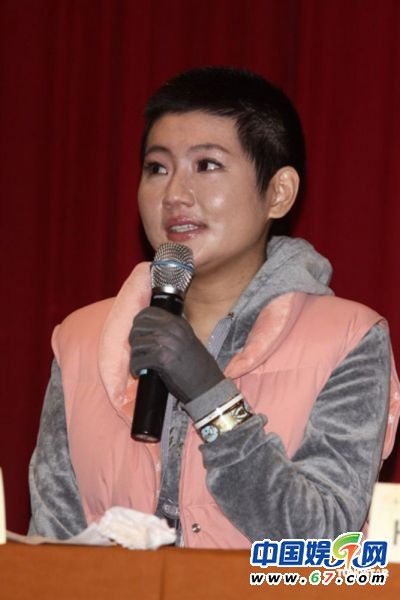 李依馨被狗咬张柏芝被刀砍 女星惨不忍睹受伤照曝光_音乐频道_凤凰网