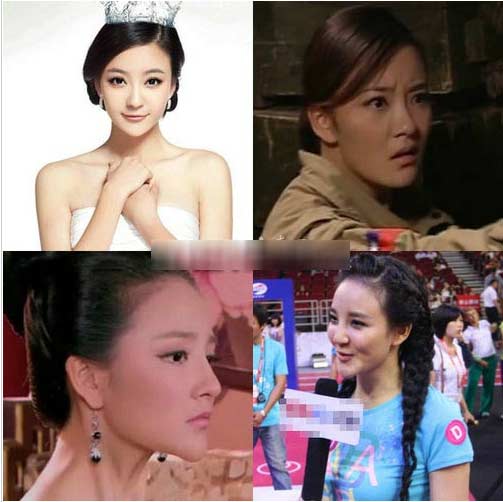 大s蔡依林袁珊珊萧亚轩李小璐女星整容惨败照片